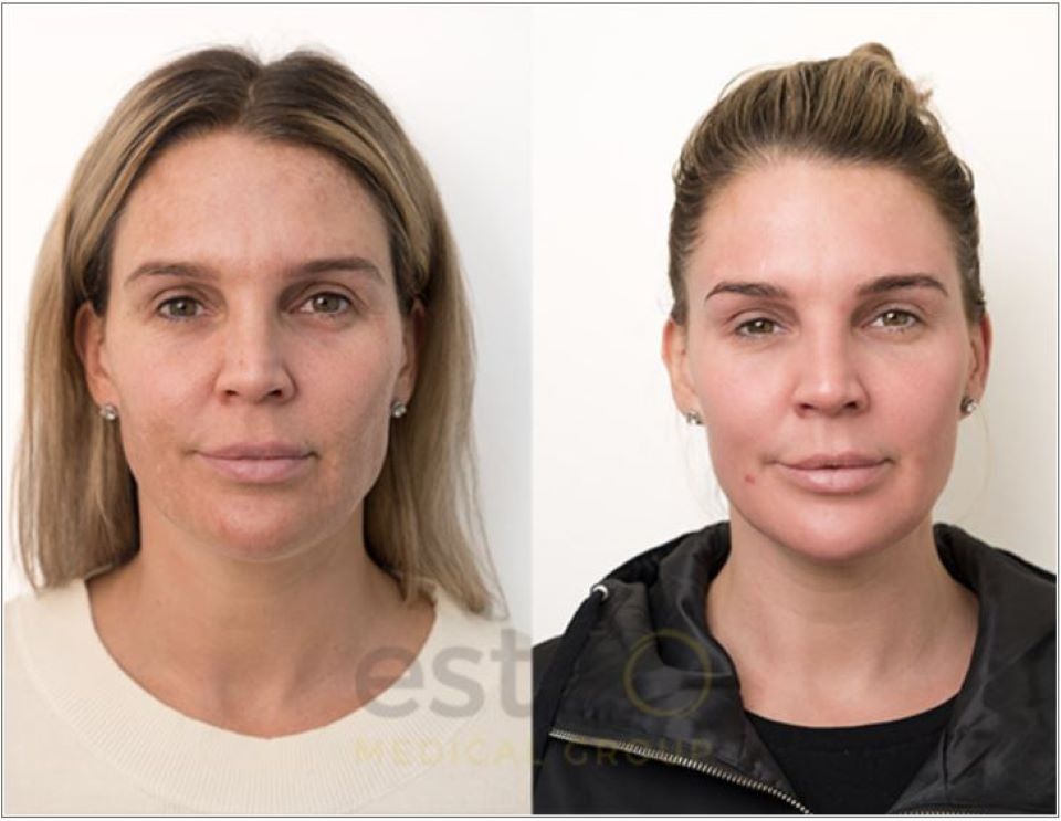 Pictures of lady before and after treatment