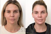 Thumbnail for Dubai Beauty Guide: Secrets to Healthy Skin in the UAE